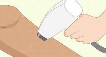 Remove Deep Ingrown Hairs