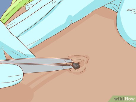 Image titled Clean Your Belly Button Step 10