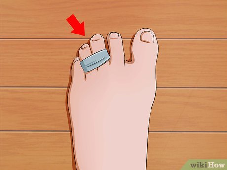 Image titled Fix Painful Shoes Step 20