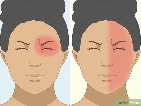 Image titled Get Rid of a Headache Step 25