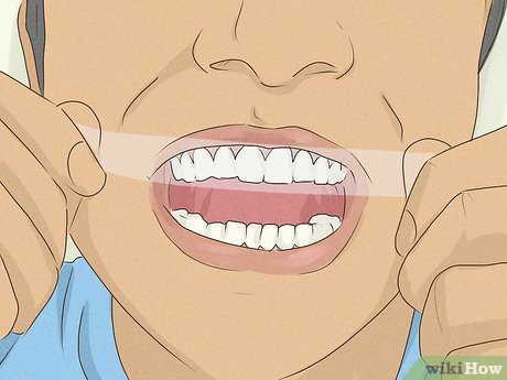 Image titled Get Whiter Teeth at Home Step 1