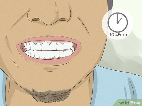 Image titled Get Whiter Teeth at Home Step 4