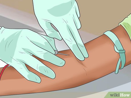 Image titled Recognize HIV Symptoms Step 15