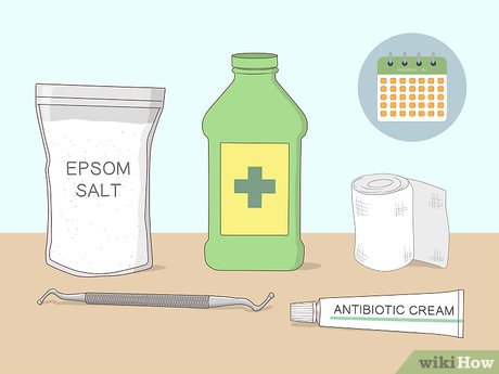 Image titled Relieve Ingrown Toe Nail Pain Step 20