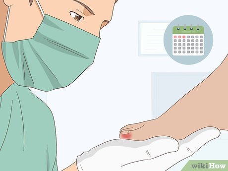 Image titled Relieve Ingrown Toe Nail Pain Step 21
