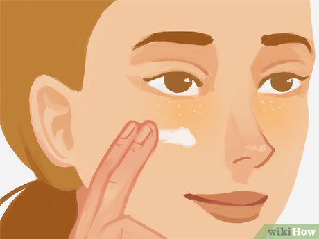 Image titled Remove Under Eye Milia Step 13