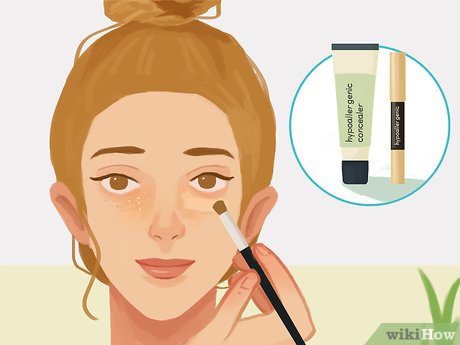 Image titled Remove Under Eye Milia Step 5