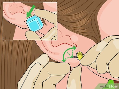 Image titled Reopen a Partially Closed Ear Piercing Hole Step 10