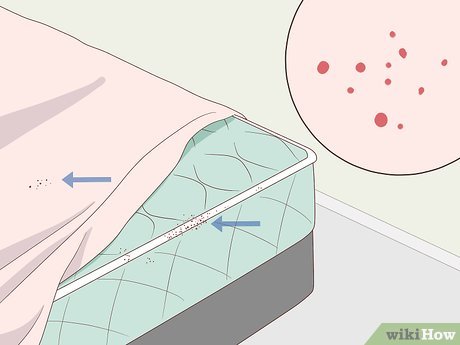 Image titled Treat Bed Bug Bites Step 3