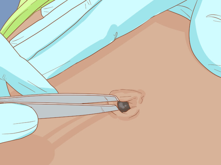 How to : How to Clean Your Belly Button