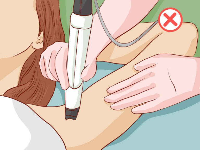 How to : How to Get Rid of Dark Armpits