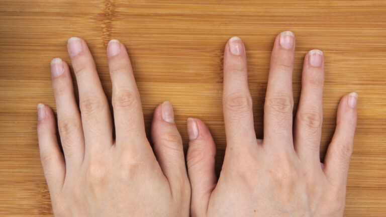 How to : How to Remove Nail Glue from Nails