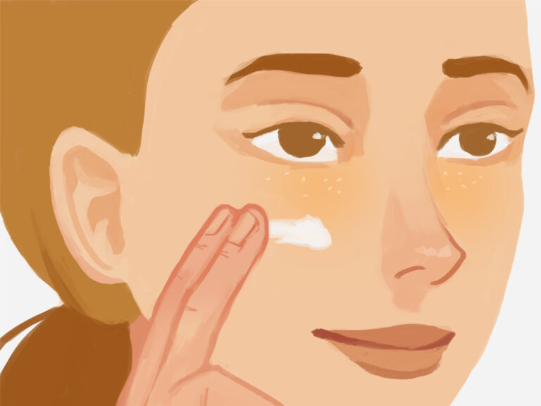 How to : How to Remove Under Eye Milia